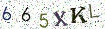 665XKL